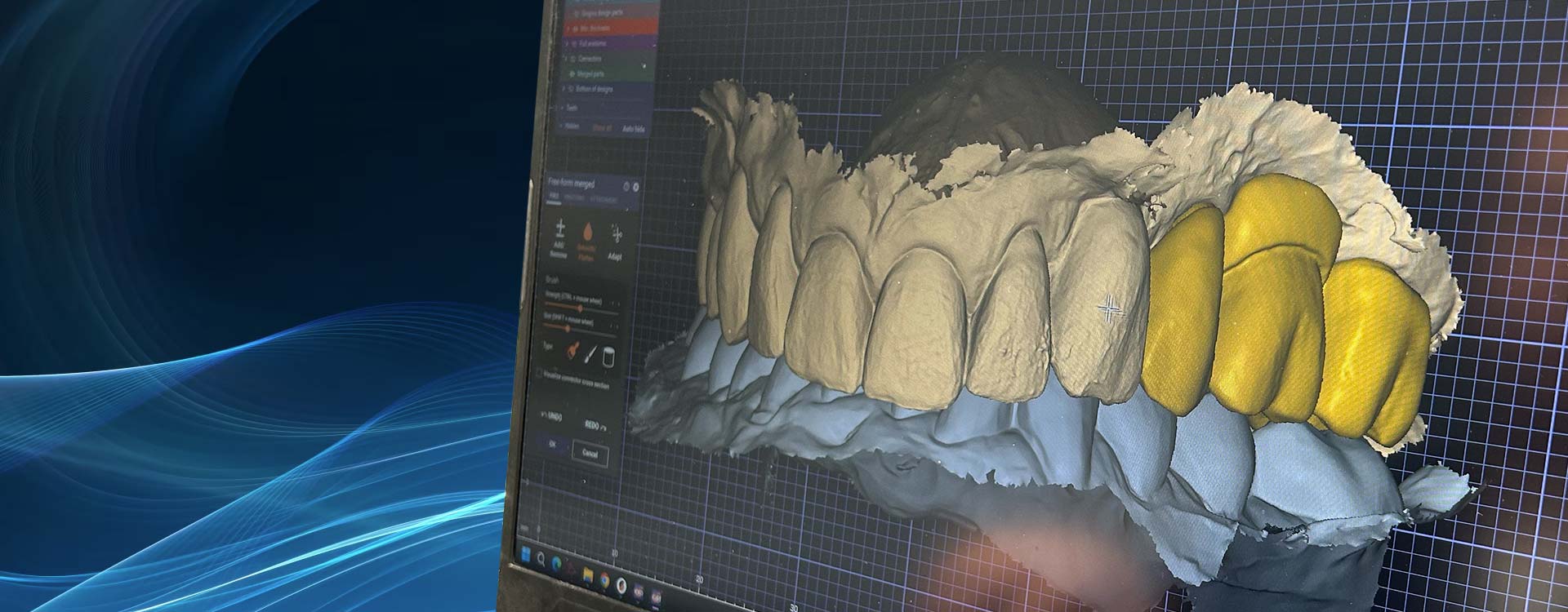 Protetyka cyfrowa 3D